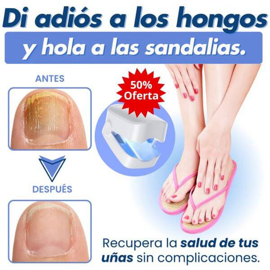 👣LÁSER PORTÁTIL ELIMINA ONICOMICOSIS EN 7 DÍAS 💫 - !LLEVATE 2X1 HOY!