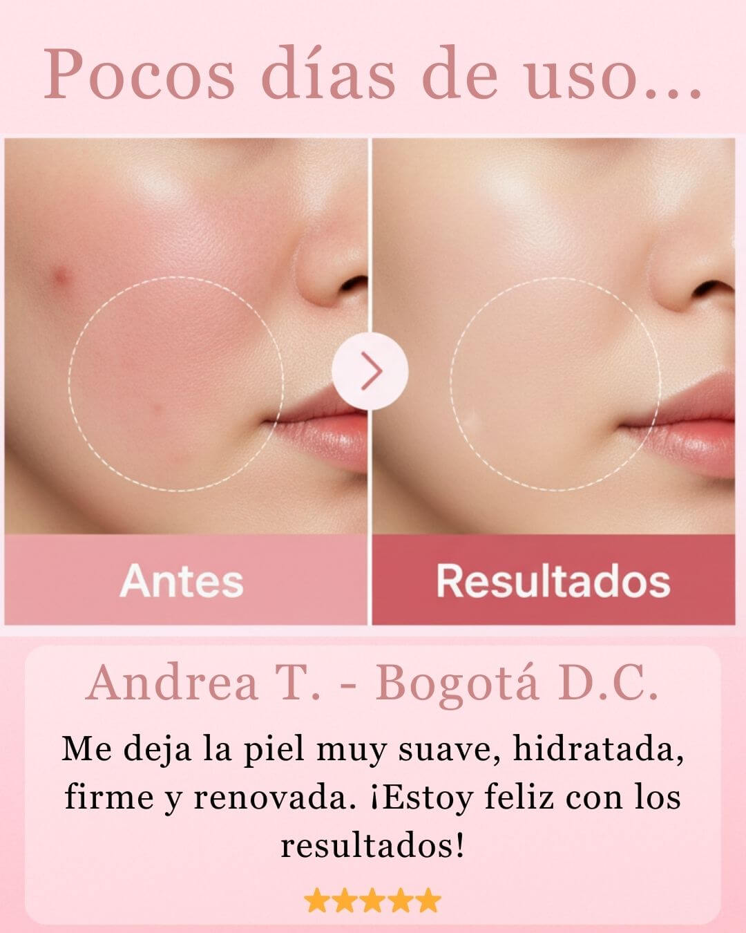 Medicube® ADN de Salmón