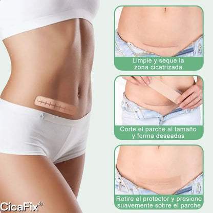 CicaFin® x2 - Reduce la apariencia de cicatrices