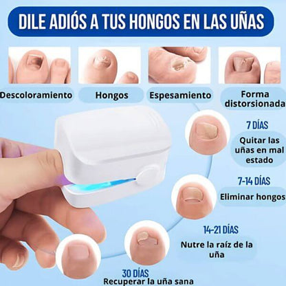 👣LÁSER PORTÁTIL ELIMINA ONICOMICOSIS EN 7 DÍAS 💫 - !LLEVATE 2X1 HOY!