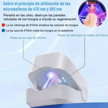 👣LÁSER PORTÁTIL ELIMINA ONICOMICOSIS EN 7 DÍAS 💫 - !LLEVATE 2X1 HOY!